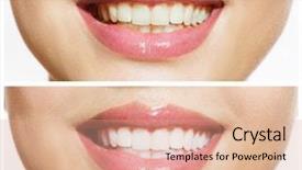  Presentation with happy smiling woman dental health - PPT layouts having teeth before and after whitening background and a coral colored foreground