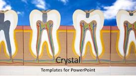  Presentation with machine tool structure - Cool new presentation theme with teeth gum - human tooth structure backdrop and a coral colored foreground