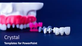  Presentation with implant - Presentation theme consisting of teeth-implant-and-crown-installation background and a navy blue colored foreground