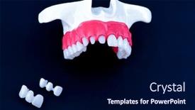  Presentation with implant - Colorful slide set enhanced with teeth-implant-and-crown-installation backdrop and a navy blue colored foreground