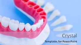  Presentation with implant - Colorful slide set enhanced with teeth-implant-and-crown-installation backdrop and a light blue colored foreground