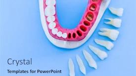  Presentation with implant - Beautiful PPT theme featuring teeth-implant-and-crown-installation backdrop and a light blue colored foreground