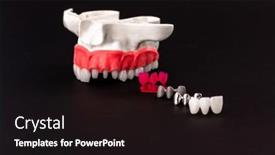  Presentation with implant - Slides enhanced with teeth-implant-and-crown-installation background and a wine colored foreground