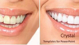  Presentation with teeth whitening - Slides enhanced with teeth whitening - smile of a beautiful young background and a coral colored foreground