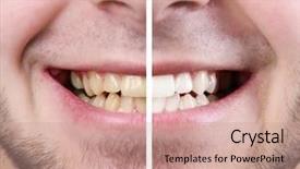  Presentation with teeth whitening - PPT theme consisting of teeth whitening - smiling man background and a coral colored foreground