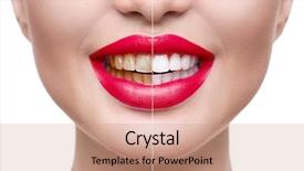 Presentation with teeth whitening - PPT layouts with teeth whitening before after woman background and a coral colored foreground