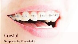  Presentation with teeth - Slides featuring teeth with braces beautiful female background and a lemonade colored foreground