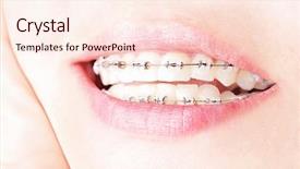  Presentation with teeth - Audience pleasing slide deck consisting of teeth with braces beautiful female backdrop and a cream colored foreground