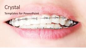  Presentation with teeth - Amazing slide deck having teeth with braces beautiful female backdrop and a lemonade colored foreground