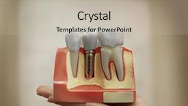  Presentation with dental implant - Audience pleasing theme consisting of teeth with dental implant backdrop and a mint green colored foreground