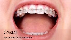  Presentation with orthodontic - Presentation theme consisting of orthodontic brackets dental health background and a coral colored foreground