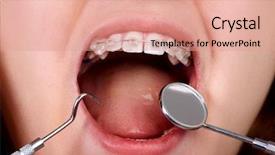  Presentation with orthodontic - Audience pleasing PPT layouts consisting of teeth with orthodontic brackets dental backdrop and a coral colored foreground