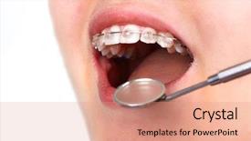  Presentation with kids dental - PPT theme with teeth with orthodontic brackets dental background and a coral colored foreground