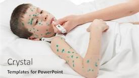  Presentation with measurement - Cool new PPT layouts with smallpox - temperature measurement sick boy backdrop and a lemonade colored foreground