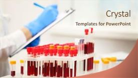  Presentation with blood test - Beautiful PPT layouts featuring test tubes filled with blood backdrop and a cream colored foreground
