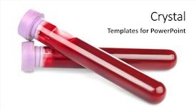  Presentation with blood test - Beautiful PPT layouts featuring test tubes with blood isolated backdrop and a white colored foreground