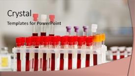  Presentation with laboratory blood test tubes - Amazing PPT theme having leukocyte - test tubes with blood samples backdrop and a light gray colored foreground