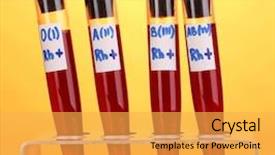  Presentation with blood test - Colorful theme enhanced with test-tubes with blood backdrop and a yellow colored foreground