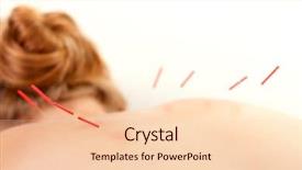  Presentation with bladder - Colorful presentation design enhanced with the first urinary bladder backdrop and a lemonade colored foreground