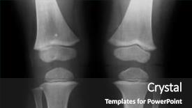  Presentation with film - Theme featuring tibia - knees on x-ray film background and a dark gray colored foreground