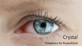  Presentation with capillary - Theme having tired capillary human eye background and a soft green colored foreground