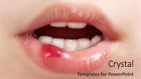  Presentation with mouth tooth - Amazing slide set having tooth pain - physical injury blood wound human backdrop and a coral colored foreground