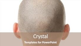  Presentation with transplant - Presentation design consisting of transplant - hair loss concept head background and a coral colored foreground