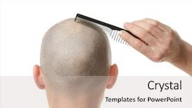  Presentation with hair loss - Cool new presentation theme with transplant - hair loss concept young man backdrop and a soft green colored foreground