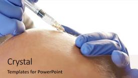  Presentation with hair loss - PPT layouts having transplant - senior man with hair loss background and a coral colored foreground