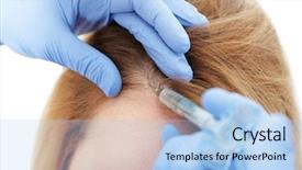  Presentation with hair loss - Beautiful slide deck featuring transplant - young woman with hair loss backdrop and a light blue colored foreground