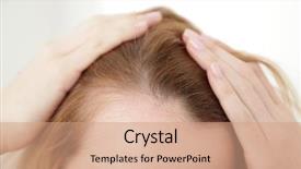  Presentation with transplant - Slide set enhanced with transplant - young woman with hair loss background and a coral colored foreground