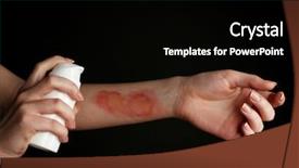  Presentation with black female - Beautiful slides featuring treatment of burns by spray backdrop and a black colored foreground