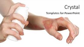  Presentation with culture and medical treatment - Slide set consisting of treatment of burns by spray background and a white colored foreground