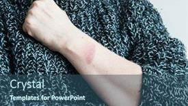  Presentation with treatment - Presentation theme consisting of treatment of burns on female hand on white background and a ocean colored foreground