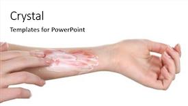  Presentation with treatment - Beautiful presentation theme featuring treatment of burns on female backdrop and a white colored foreground