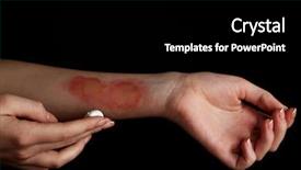  Presentation with black female - Slide deck enhanced with treatment of burns on female background and a black colored foreground