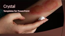  Presentation with black female - Beautiful PPT theme featuring treatment of burns on female backdrop and a wine colored foreground