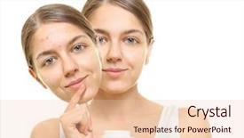  Presentation with acne woman - Audience pleasing presentation theme consisting of treatment on white background skin backdrop and a lemonade colored foreground