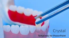  Presentation with jaw - Theme having tweezers-pulling-tooth background and a light blue colored foreground