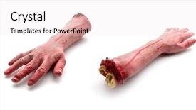  Presentation with wound - Presentation enhanced with wound infection - two artificial human bloody arms background and a sky blue colored foreground