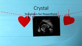  Presentation with baby ultrasound - Theme with ultrasound of baby hanging background and a light blue colored foreground