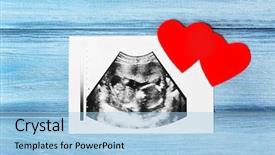  Presentation with baby ultrasound - Amazing PPT theme having ultrasound of baby on wooden backdrop and a light blue colored foreground