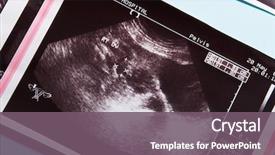  Presentation with pelvis - Beautiful presentation featuring a woman's pelvis backdrop and a gray colored foreground