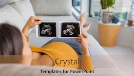  Presentation with fetus - Presentation theme having ultrasound-showing-fetus-pregnancy-concept background and a yellow colored foreground