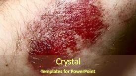  Presentation with wound - PPT theme featuring up of a scratched wound background and a tawny brown colored foreground