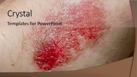  Presentation with wound - Cool new PPT layouts with up of a scratched wound backdrop and a soft green colored foreground