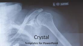  Presentation with shoulder - Amazing theme having up of an x-ray backdrop and a light blue colored foreground
