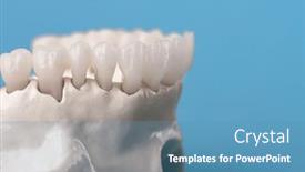  Presentation with jaw - Presentation design consisting of upper-human-jaw-with-teeth background and a teal colored foreground