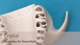  Presentation with dental implant - PPT theme enhanced with upper-human-jaw-without-teeth background and a soft green colored foreground