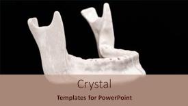  Presentation with dental implant - Presentation theme having upper-human-jaw-without-teeth background and a coral colored foreground